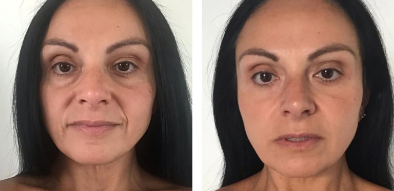 I Didn’t Recognize Myself in the Mirror—Until I Found This Secret