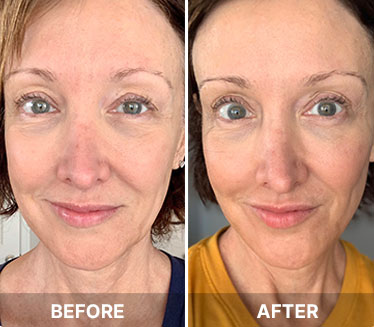 Okinawan Anti-Aging Secret